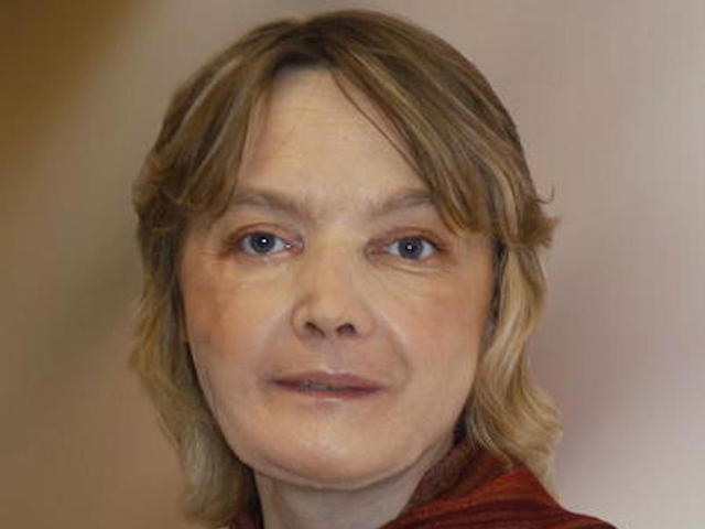 Woman who received world's first partial face transplant dies