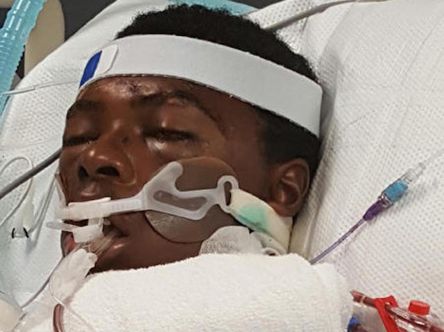 Man dies days after fight with police; lawyer blames cops